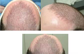 Antonio Joao Goulart - Foto 1